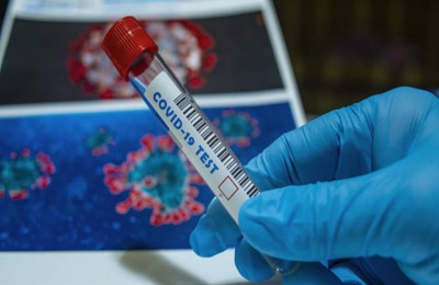 Laboratórios veterinários poderão produzir vacinas contra coronavírus